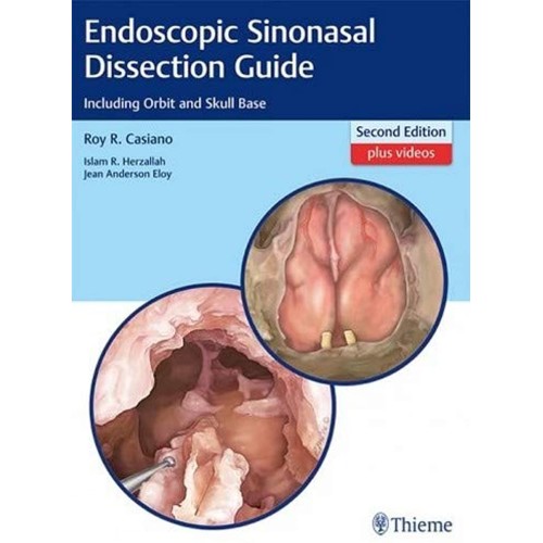 Endoscopic Sinonasal Dissection Guide 2nd Ed Indian Reprint