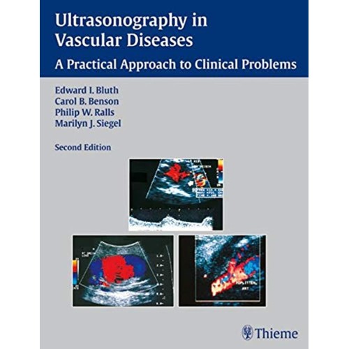 Ultrasonography in Vascular Diseases