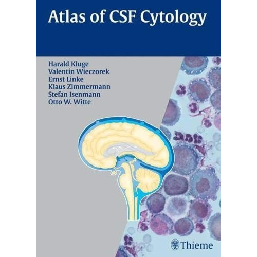 Atlas of CSF Cytology