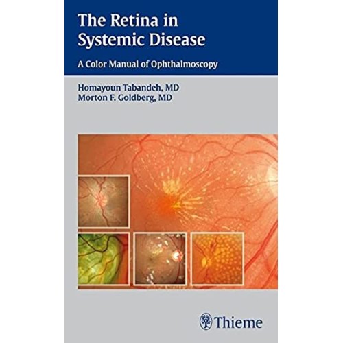 The Retina in Systemic Disease