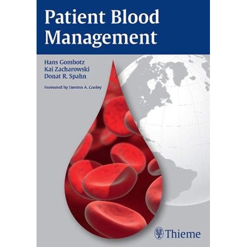 Patient Blood Management 1st Edition