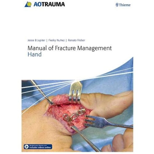 AO Manual of Fracture Management - Hand 1st Edition