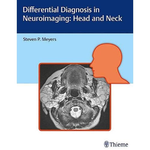 Differential Diagnosis in Neuroimaging Head and Neck 1st Edition