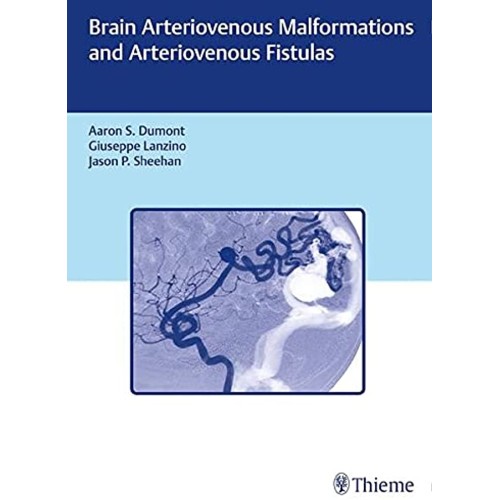 Brain Arteriovenous Malformations and Arteriovenous Fistulas 1st Edition