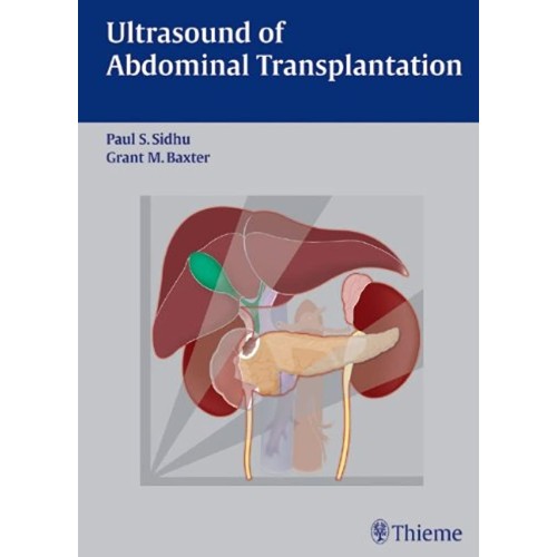 Ultrasound of Abdominal Transplantation