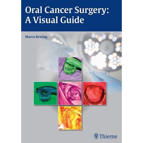 Oral Cancer Surgery: A Visual Guide 1st Editi...