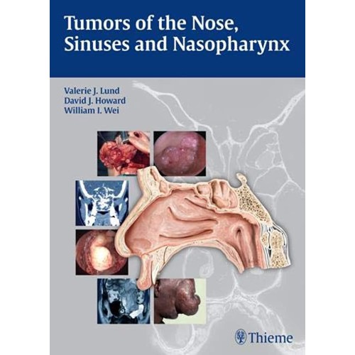 Tumors of The Nose , Sinuses, and Nasopharynx