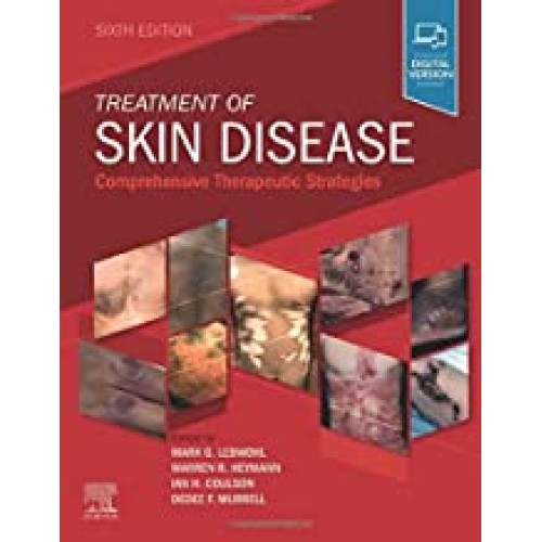 Treatment of Skin Disease-6E