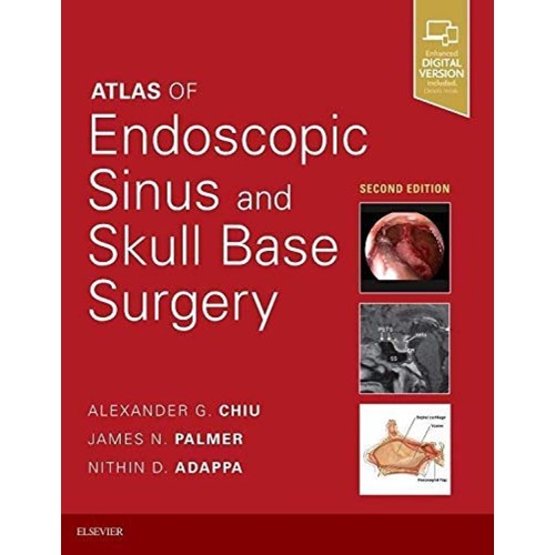 Atlas of Endoscopic Sinus and Skull Base Surgery: Expert Consult - Online and Print - 2E