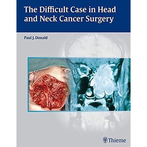 THE DIFFICULT CASE IN HEAD AND NECK CANCER SU...