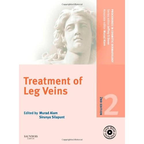 PCDS: Treat of Leg Veins 2/e