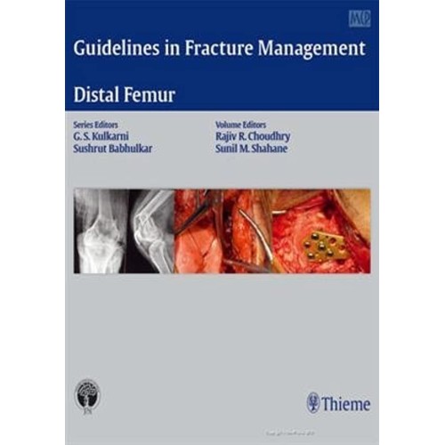 Guidelines in Fracture Management - Distal Femur