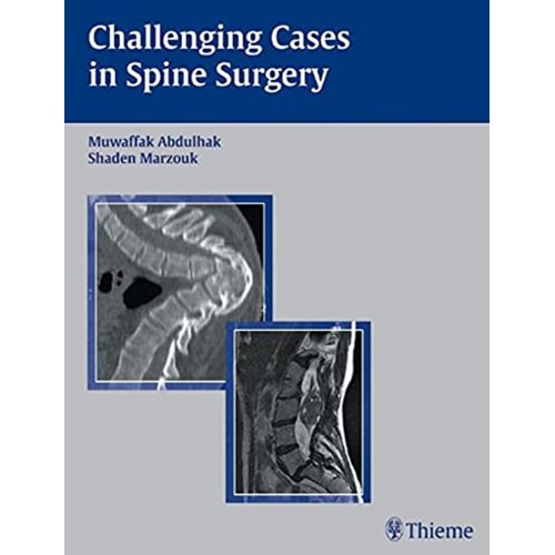 Challenging Cases in Spine Surgery