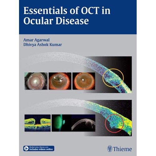 Essentials of OCT in Ocular Disease