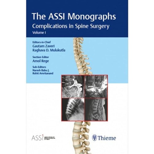 The ASSI Monographs-Complications in Spine Surgery