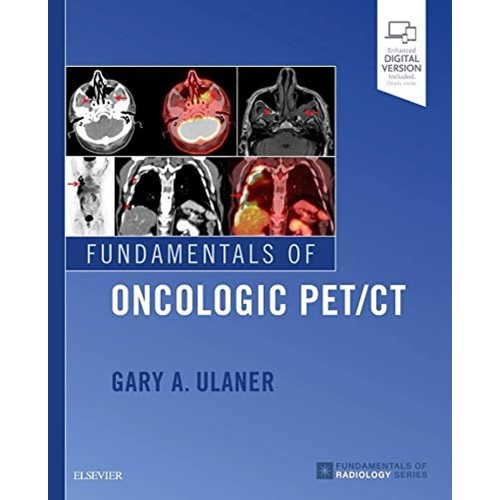 Fundamentals of PET/CT -1E