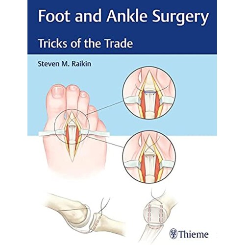 Foot and Ankle Surgery : Tricks of the Trade 1st Edition