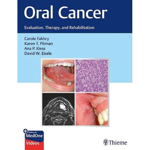 Oral Cancer : Evaluation, Therapy, and Rehabilitation 1st Ed.