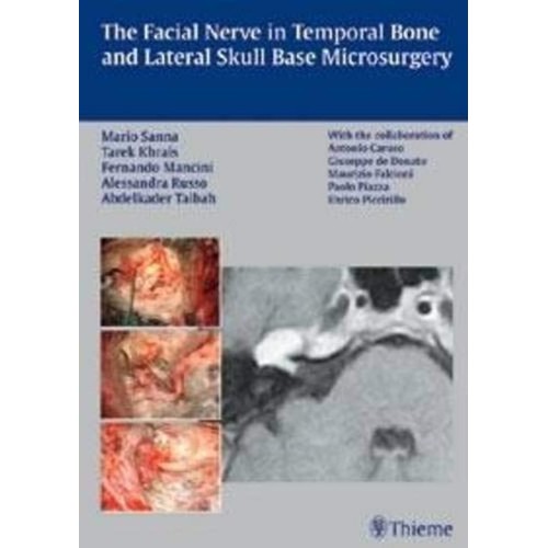 The Facial Nerve in Temporal Bone and Lateral...