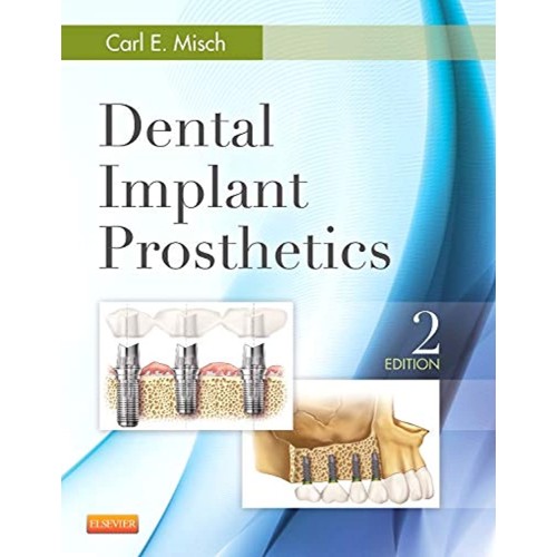 Dental Implant Prosthetics 2/e