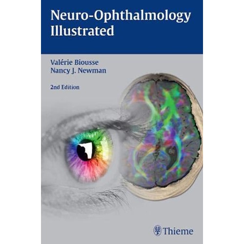 Neuro-Ophthalmology IIIustrated 2nd Edition