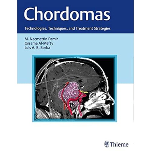 Chordomas Technologies, Techniques, and Treatment Strategies 1st Edition