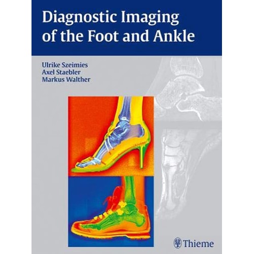 Diagnostic Imaging of the Foot and Ankle