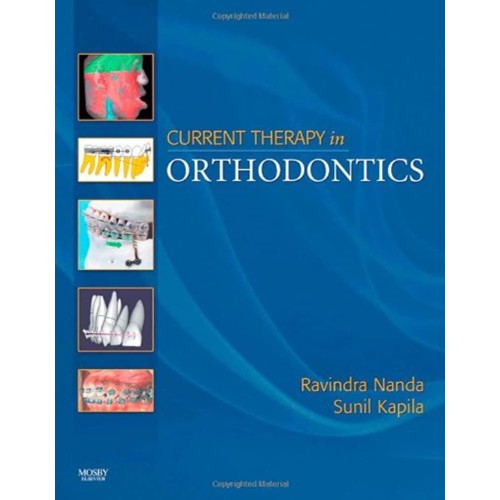 Current Therapy in Orthodontics - 1E