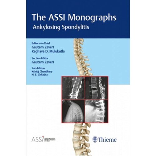 The ASSI Monographs-Ankylosing Spondylitis