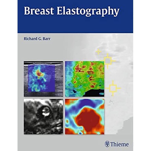 Breast Elastography