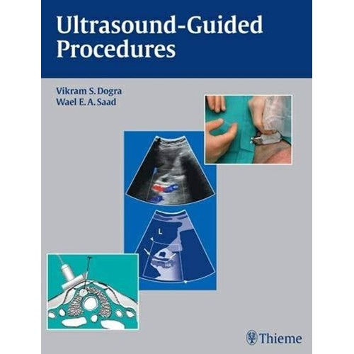 Ultrasound Guided Procedures