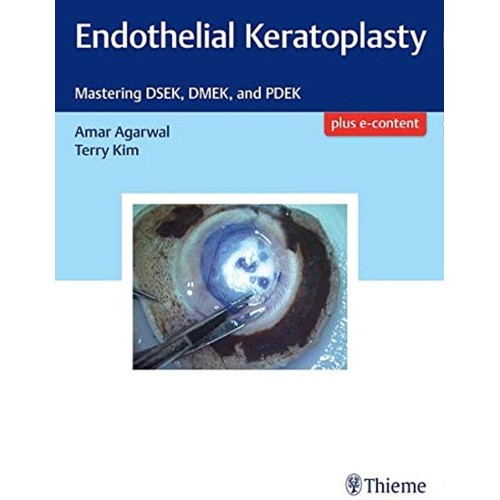 Endothelial Keratoplasty 1st Edition