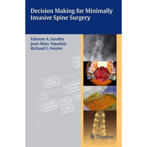 Decision Making for Minimally Invasive Spine ...