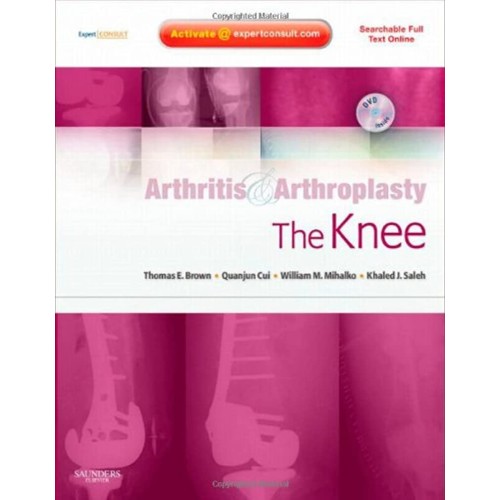 Arthritis& Arthroplasty- The Knee-1E