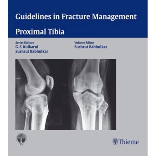 Proximal Tibia