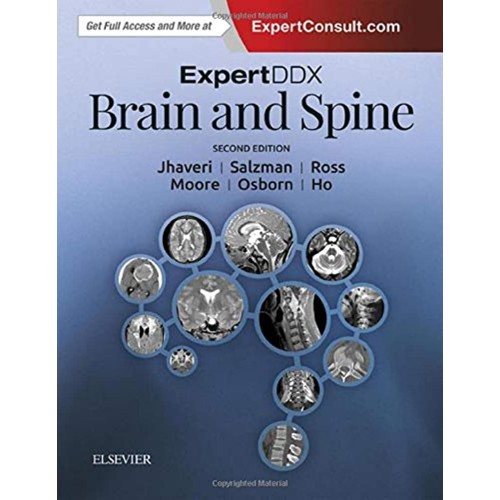 ExpertDDx: Brain and Spine - 2E