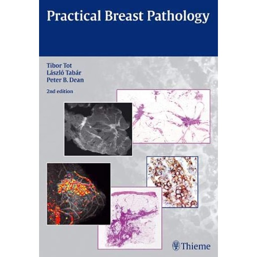 Practical Breast Pathology 2nd Edition