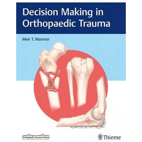 Decision Making in Orthopaedic Trauma 1st Ed....