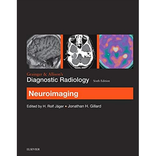 Grainger & Allison’s Diagnostic Radiology: Neuroimaging