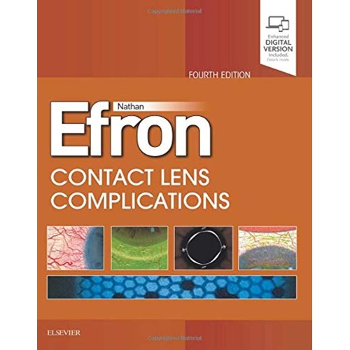 Contact Lens Complications - 4E