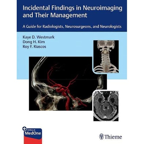 Incidental Findings in Neuroimaging and Their Management 1st Ed.