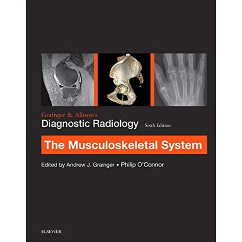 Grainger & Allison’s Diagnostic Radiology: Musculoskeletal System