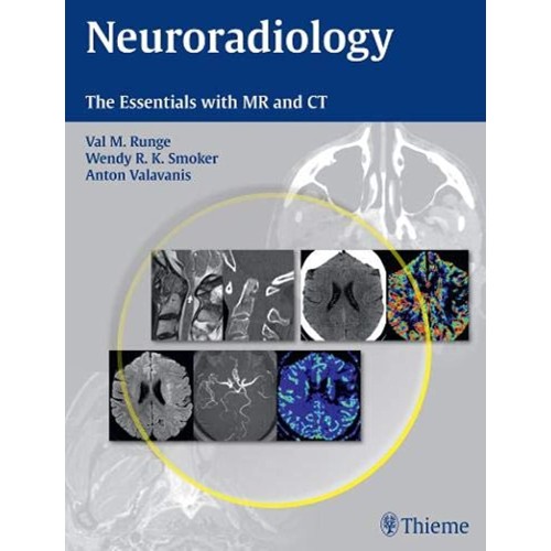 Neuroradiology-The Essentials with MR and CT