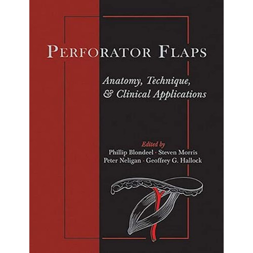 Perforator Flaps: Anatomy, Technique, & Clini...