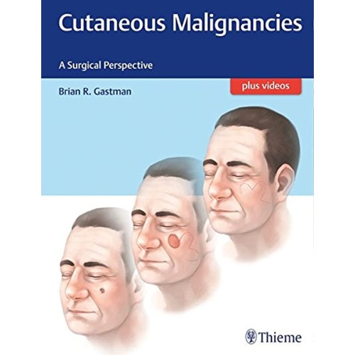 Cutaneous Malignancies A Surgical Perspective 1st Edition