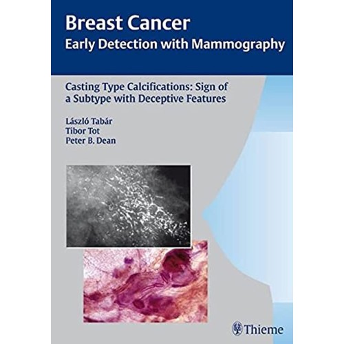 Casting Type Calcifications Sign of a Subtype...