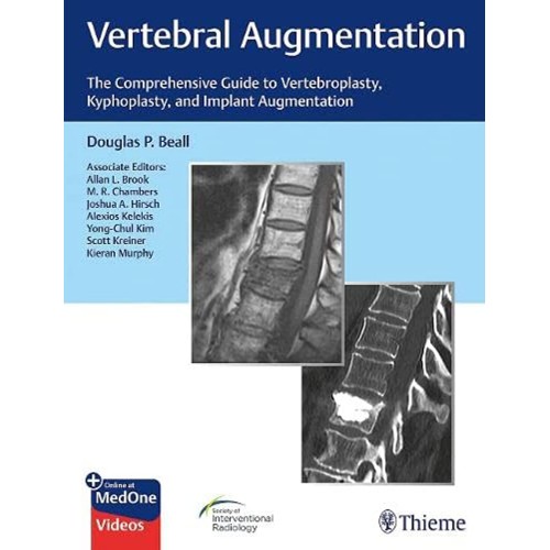 Vertebral Augmentation 1st Ed.