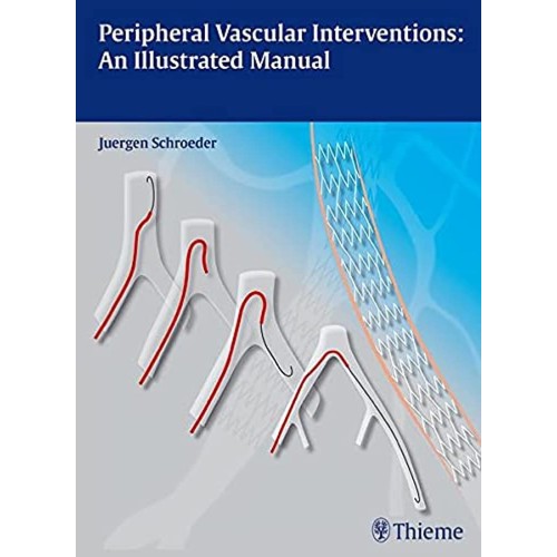 Peripheral Vascular Interventions An Illustrated M