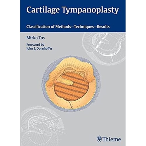 CARTILAGE TYMPANOPLASTY