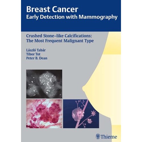 Breast Cancer: Early Detection with Mammograp...